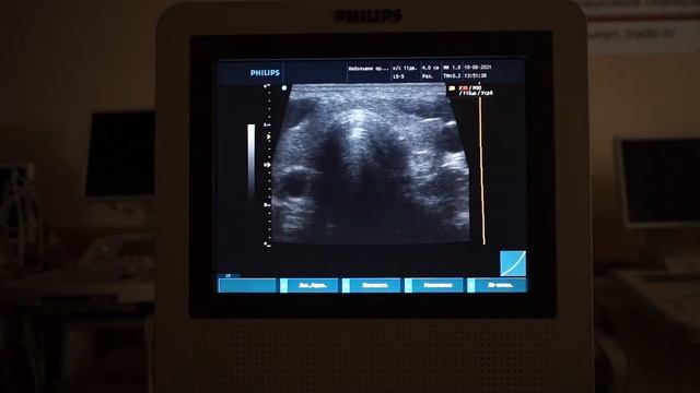 Philips HD3 обзор ультразвукового сканера смотреть онлайн