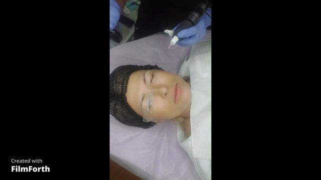 КАМУФЛЯЖ РУБЦОВ ПОСЛЕ БЛЕФАРОПЛАСТИКИ| Мастер медицинского камуфляжа в Киеве смотреть онлайн