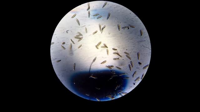 Инфузория-туфелька под микроскопом смотреть онлайн