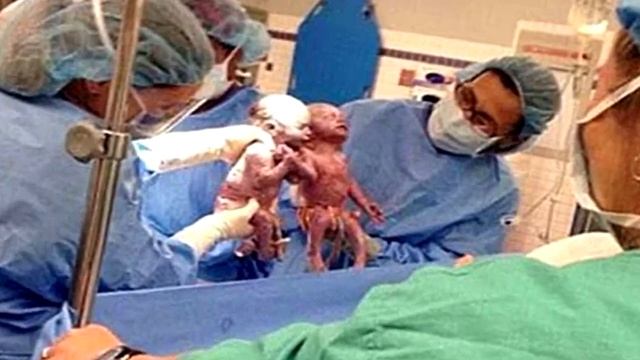 Спустя НЕСКОЛЬКО секунд после родов у акушера-гинеколога ОТВИСЛА челюсть, когда он увидел близнецов смотреть онлайн