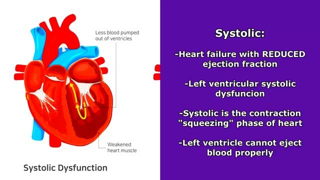 Left-Sided Heart Failure vs Right-Sided Heart Failure Pathophysiology Nursing NCLEX Review смотреть онлайн