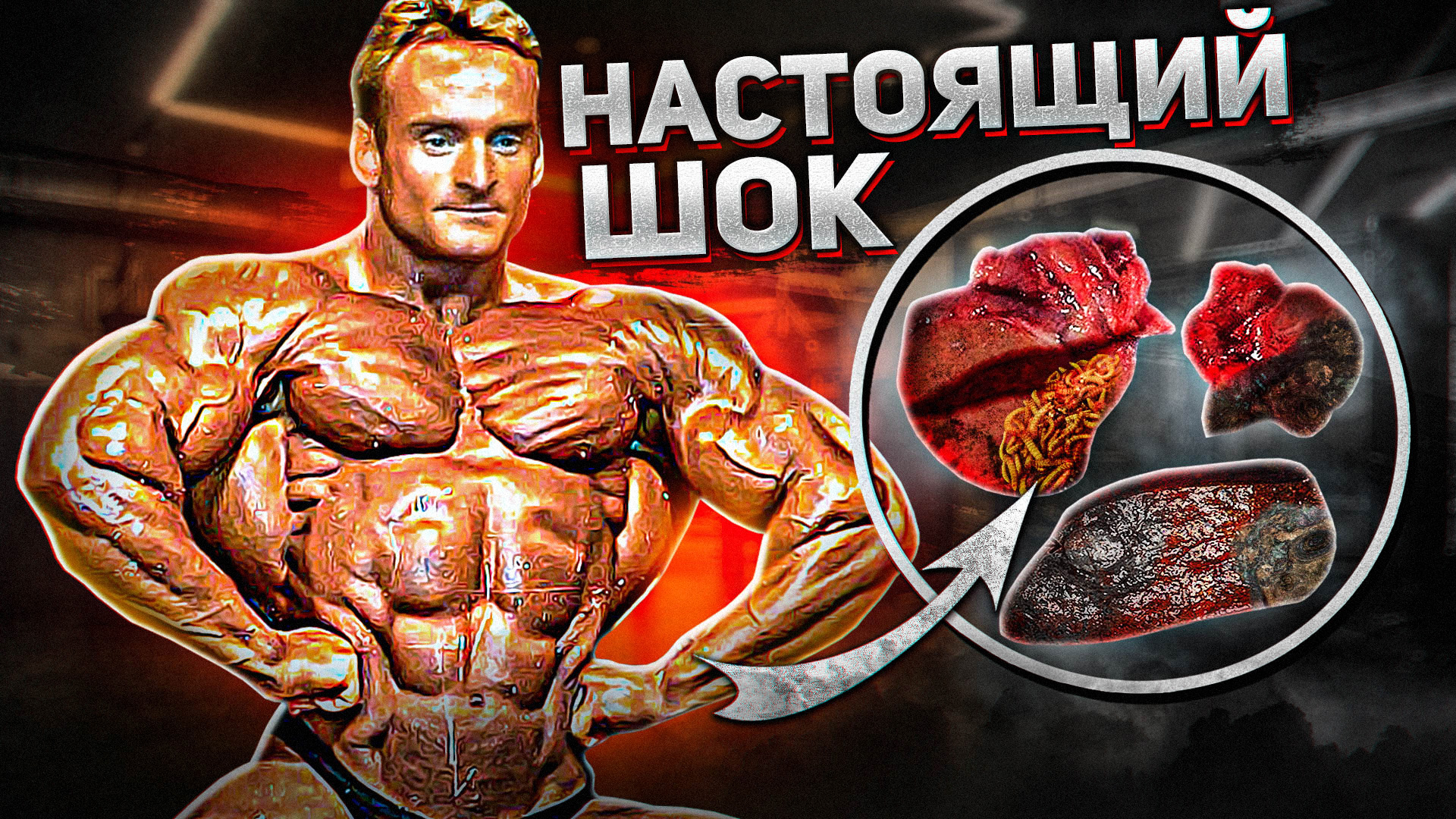 0% ЖИРА. ОТКАЗ ОРГАНОВ И СМЕРТЬ АНДРЕАСА МЮНЦЕРА смотреть онлайн