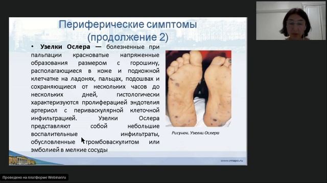 Вебинар5 по кардиологии. Федоришина О.В..mp4