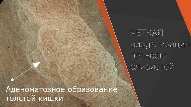 Экспертная гастроскопия и колоноскопия в станице Ленинградской смотреть онлайн