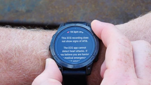 Garmin ECG Expands To Fenix, Epix, And More!