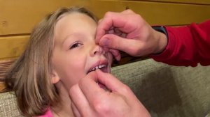 Смелая девочка покажет, как вырвать молочный зуб ниткой | How to pull a baby tooth out