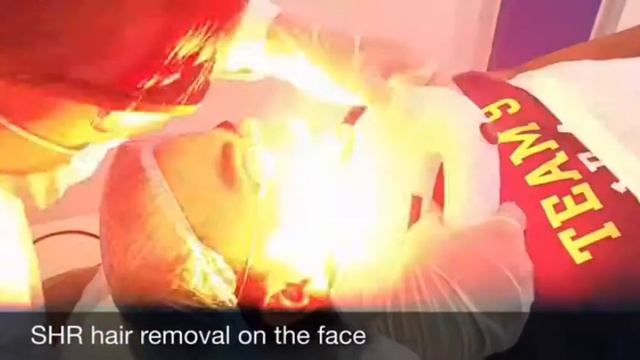 shr IPL hair removal смотреть онлайн