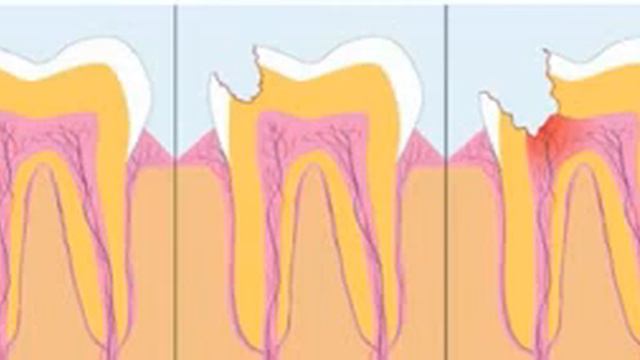 Самый лучший способ позаботиться о своих зубах