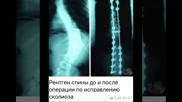 Human body: Рентген спины…/08.10.22 смотреть онлайн