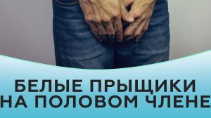 Белые прыщики на половом члене