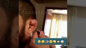 Выкачевают кровь из уха ??