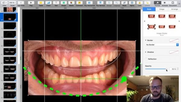 DSD. Digital Smile Design. Keynote in Russian