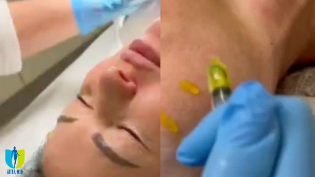 BioRePeelCl3 смотреть онлайн