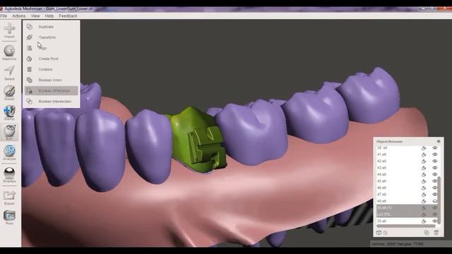 Брекеты в 3D смотреть онлайн
