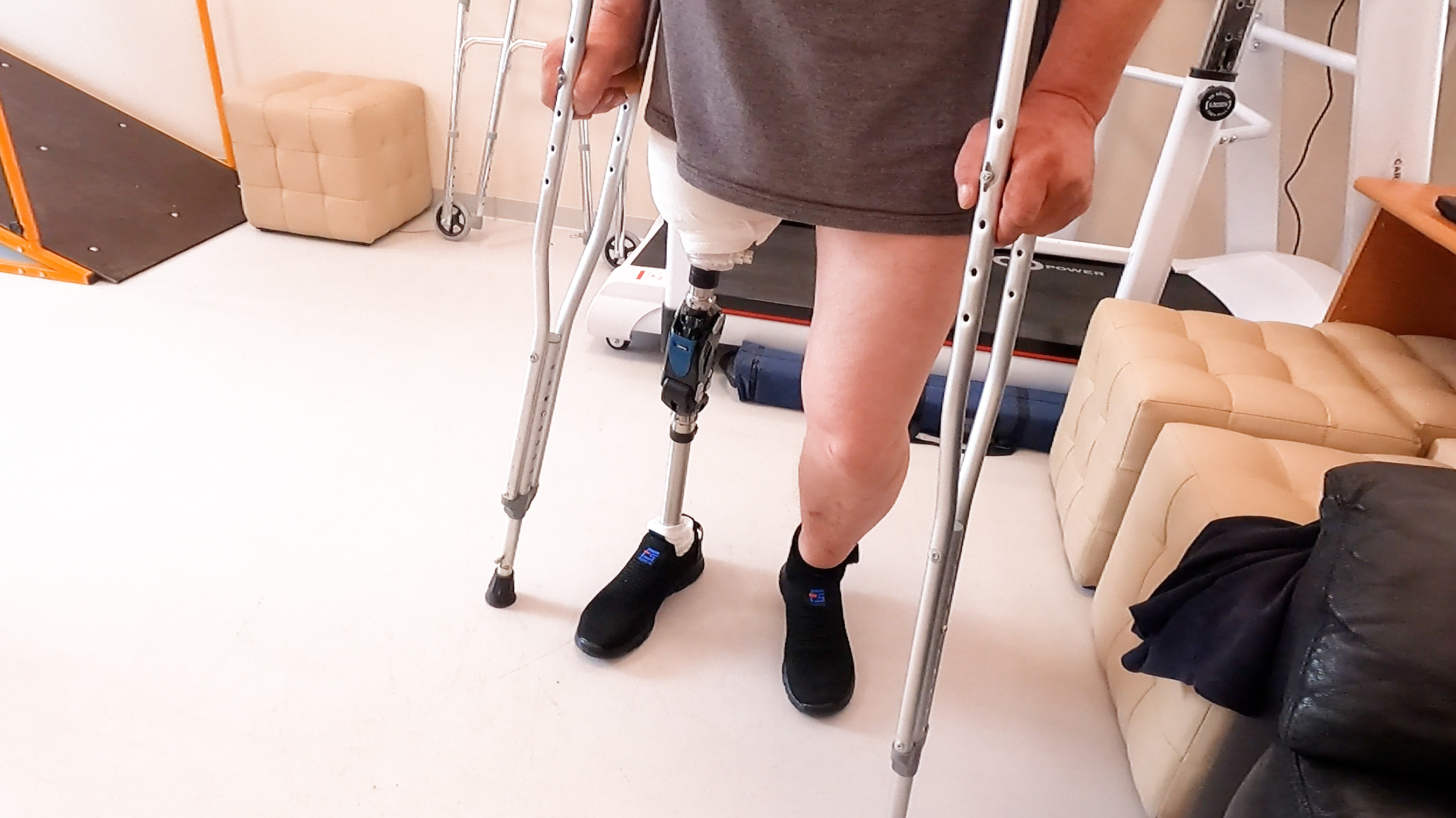 Первый протез ноги и первые 5 дней смотреть онлайн