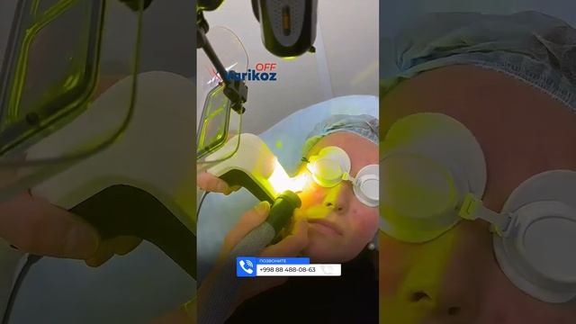 ЛАЗЕРНОЕ ЛЕЧЕНИЕ розацеа на лице смотреть онлайн