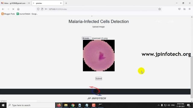 Classification of Malaria-Infected Cells using Convolutional Neural Networks | Python Project смотреть онлайн