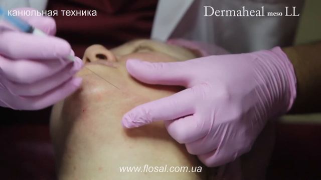 Dermaheal LL, канюльная техника [ WorkShop4.me ]