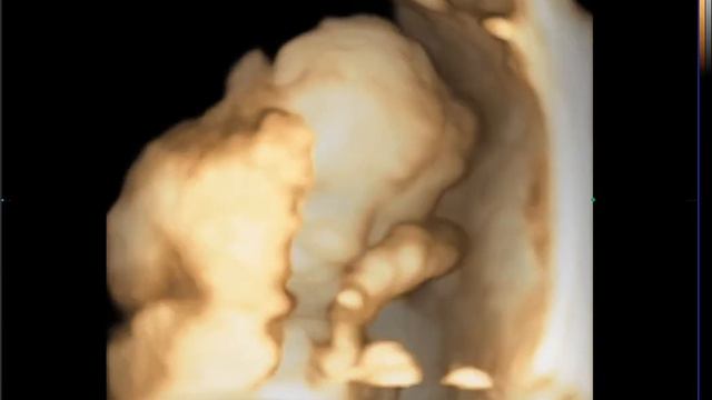 4 Д УЗИ в Самарканде смотреть онлайн