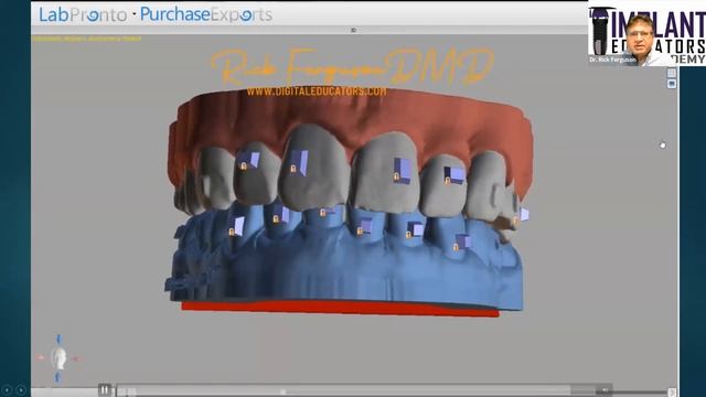 Dental 3D Printing and BlueSkyPlan in 2022-Use Parameters for Dental 3D printers and the Role of BS смотреть онлайн