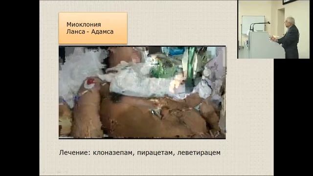 Кондратьев А.Н.  Реабилитация в нейрореанимации