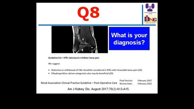 Immunosuppression Tutorial Prof Hussein Sheashaa, Monday 20 Nov 2017 смотреть онлайн