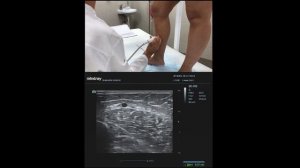 Технология УЗИ вен нижних конечностей