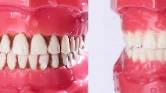 ADAE dental water flosser смотреть онлайн