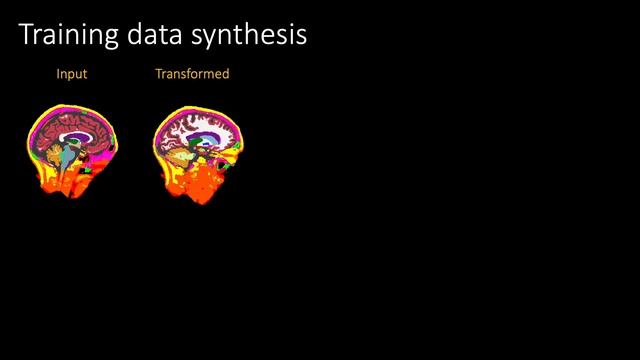 SynthStrip: Skull-Stripping for Any Brain Image смотреть онлайн