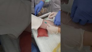 Забор катетер бабочка