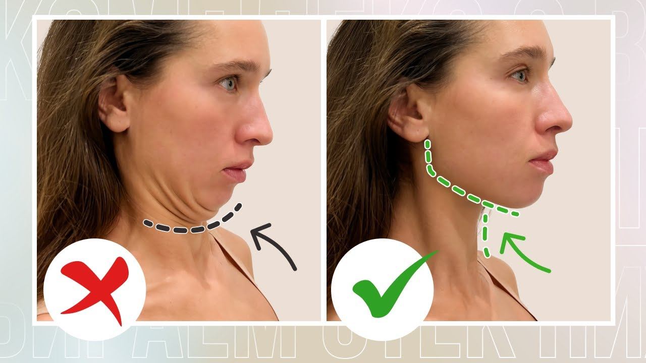 Идеальный ОВАЛ ЛИЦА | Как убрать ВТОРОЙ ПОДБОРОДОК, отеки лица и вернуть угол молодости? смотреть онлайн