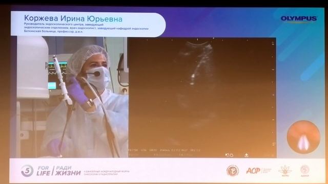 03 9 Live Коржева ИЮ Техника EBUS TBNA при саркоидозе