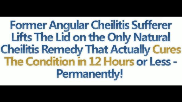Angular Cheilitis Treatment | Treatment For Angular Stomatitis Causes and Symptoms смотреть онлайн