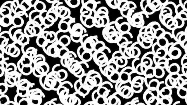 Absolute Infinity Minus 1 = ???