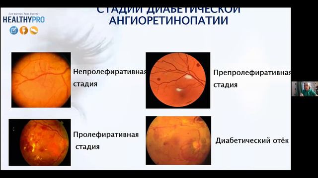 Все Секреты Ваших Глаз