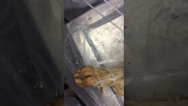 Сердечно-сосудистая система. Нижние конечности (18+)