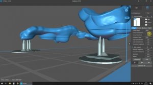 Параметры поддержек в слайсере ChiTuBox