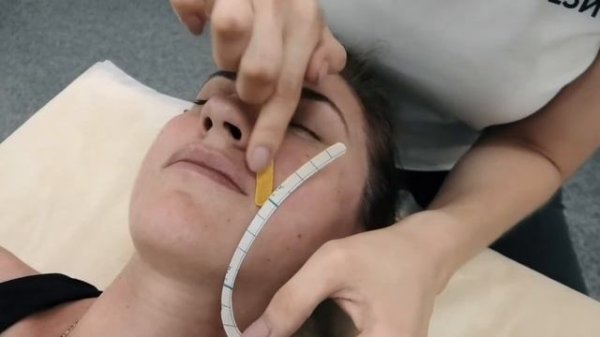 Тейпирование носогубных складок