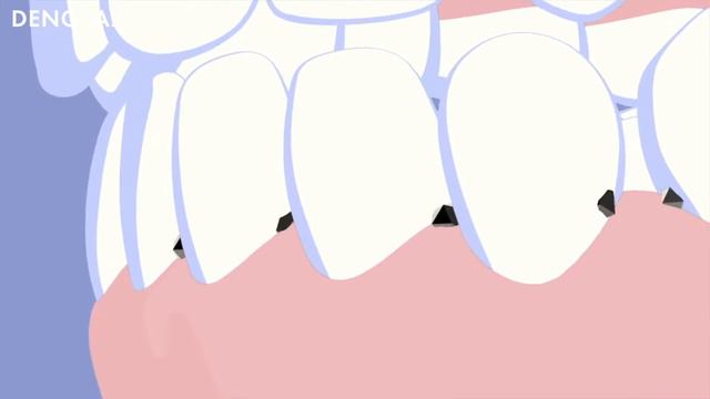 Что такое Oral BIO-Complex от DENOVA? смотреть онлайн