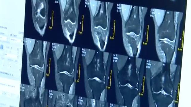 I ОНКОЛОГИЧЕСКИЙ ФОРУМ УРАЛЬСКОГО ФЕДЕРАЛЬНОГО ОКРУГА, Екатеринбург, 2016 смотреть онлайн