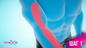 Kinexib - тейпирование латерального эпикондилита