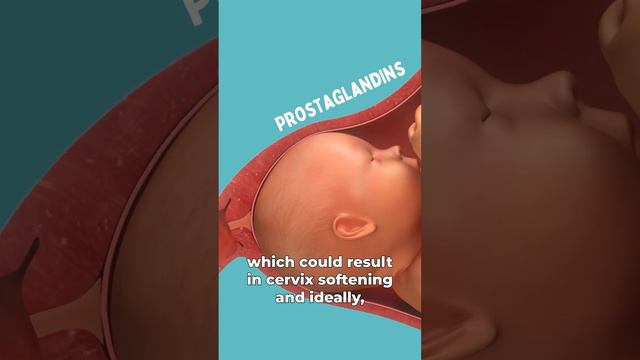 Membrane Sweep Procedure (stretch and sweep) #pregnancy #birth смотреть онлайн