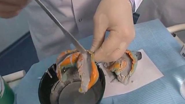 Индивидуальные каппы часть 2 смотреть онлайн