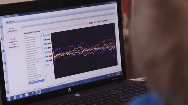 Beyond Chiropractic: Electrodermographic Therapy смотреть онлайн