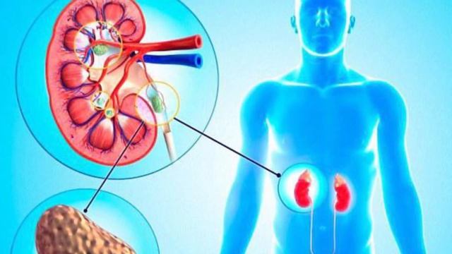 Привычки которые вредят нашим почкам смотреть онлайн