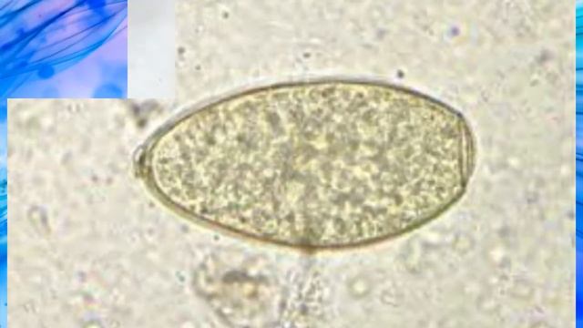 Fasciola Hepatica Eggs Morphology смотреть онлайн