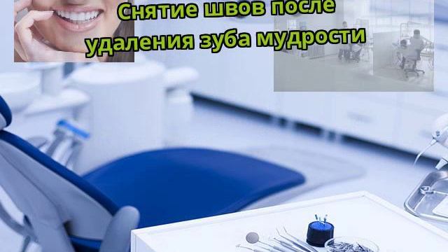 Снятие швов после удаления зуба мудрости смотреть онлайн