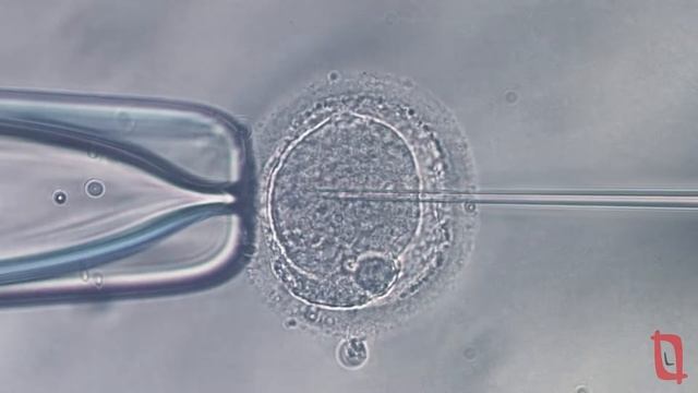 Рекламный ролик клиники Aurora IVF