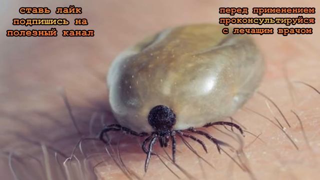 ★Средство от ВШЕЙ и ГНИД, которое действительно работает. Педикулез излечим. смотреть онлайн