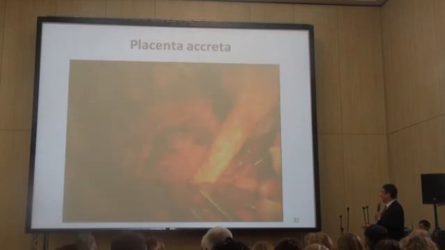 МА Курцер Management of placenta accreta in patients with uterine scar after previous CS смотреть онлайн